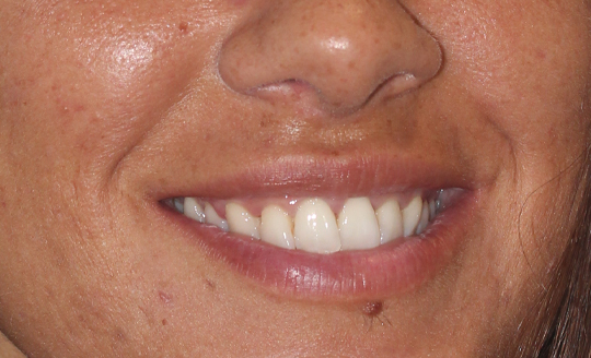 Melissa Pinto antes
